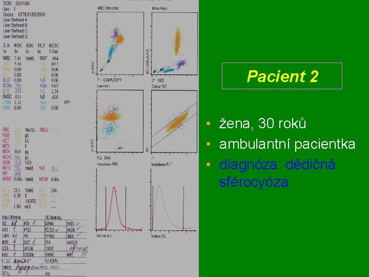 Pacient 2 • žena, 30 roků • ambulantní pacientka • diagnóza: dědičná sférocyóza 