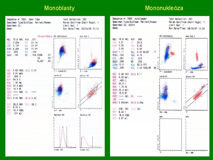 Monoblasty Mononukleóza 