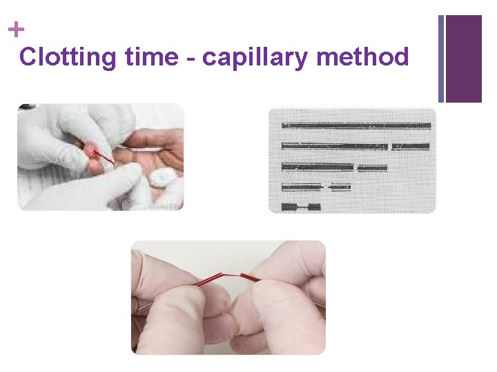 + Clotting time - capillary method 