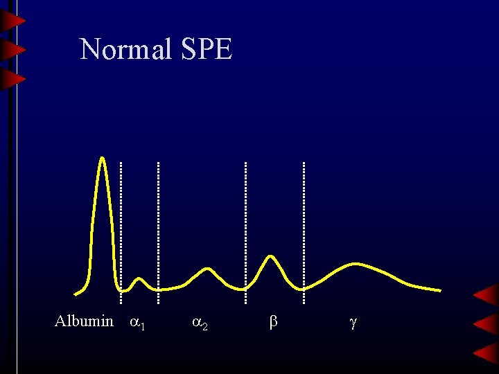 Normal SPE Albumin 1 2 