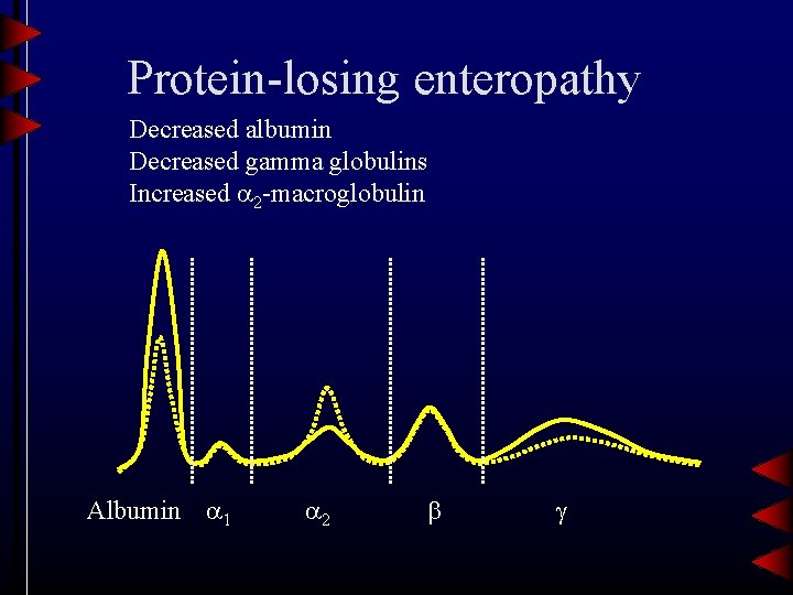 Protein-losing enteropathy Decreased albumin Decreased gamma globulins Increased 2 -macroglobulin Albumin 1 2 