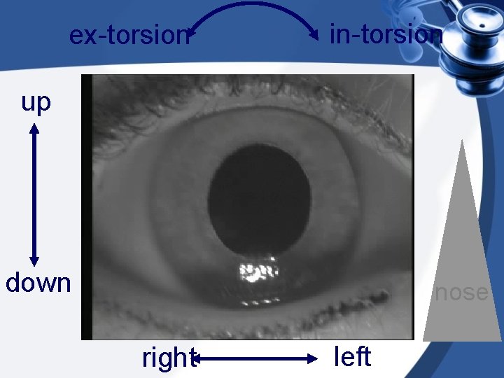 ex-torsion in-torsion up down nose right left 