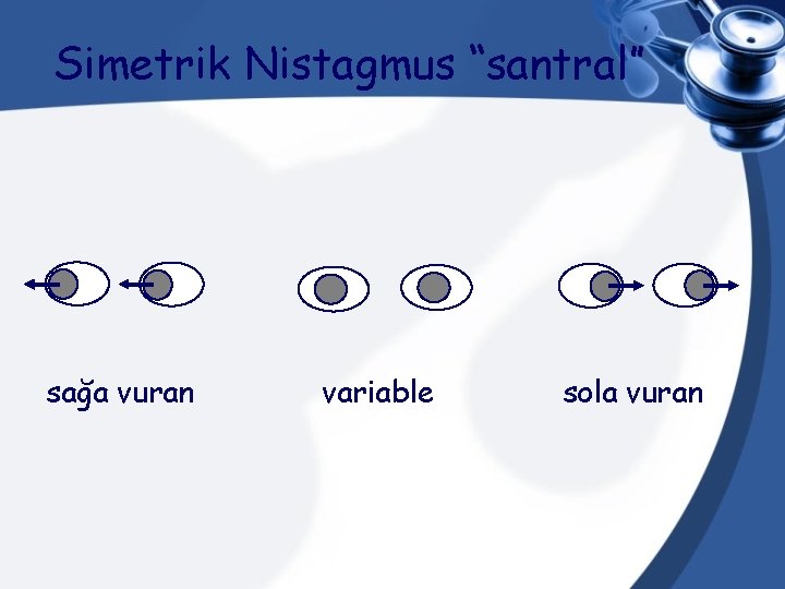 Simetrik Nistagmus “santral” sağa vuran variable sola vuran 