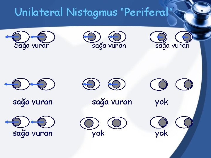 Unilateral Nistagmus “Periferal” Sağa vuran sağa vuran yok sağa vuran yok 