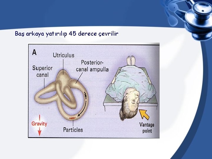 Baş arkaya yatırılıp 45 derece çevrilir 