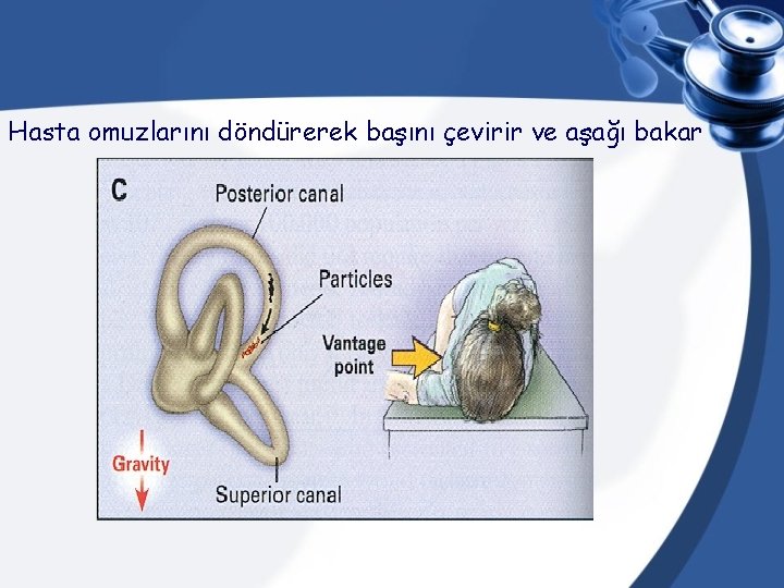 Hasta omuzlarını döndürerek başını çevirir ve aşağı bakar 