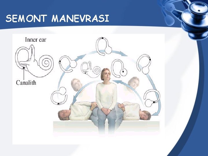 SEMONT MANEVRASI 
