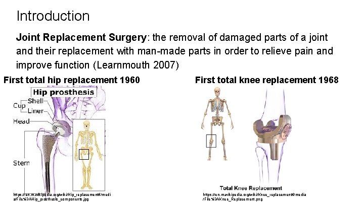 Introduction Joint Replacement Surgery: the removal of damaged parts of a joint and their