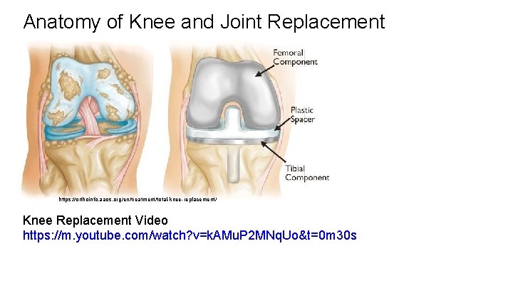 Anatomy of Knee and Joint Replacement https: //orthoinfo. aaos. org/en/treatment/total-knee-replacement/ Knee Replacement Video https: