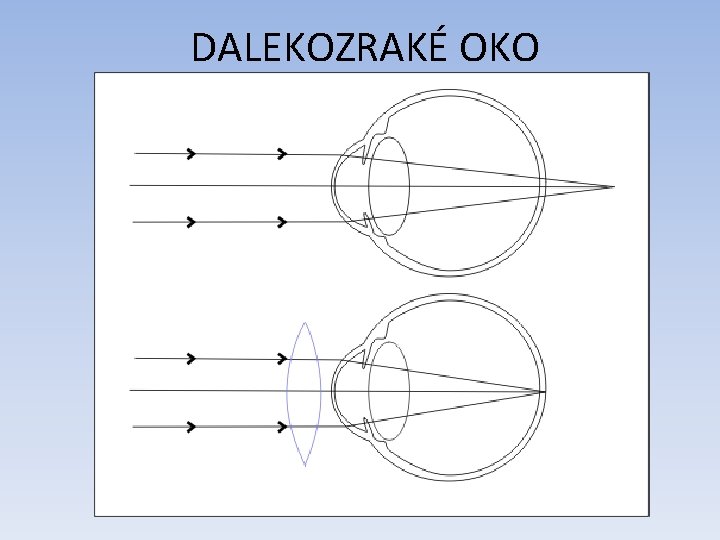 DALEKOZRAKÉ OKO DALEKOZRAKÉ OKO