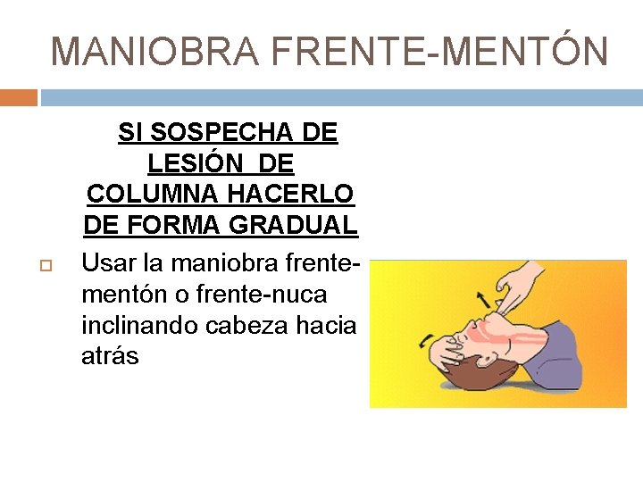 MANIOBRA FRENTE-MENTÓN SI SOSPECHA DE LESIÓN DE COLUMNA HACERLO DE FORMA GRADUAL Usar la