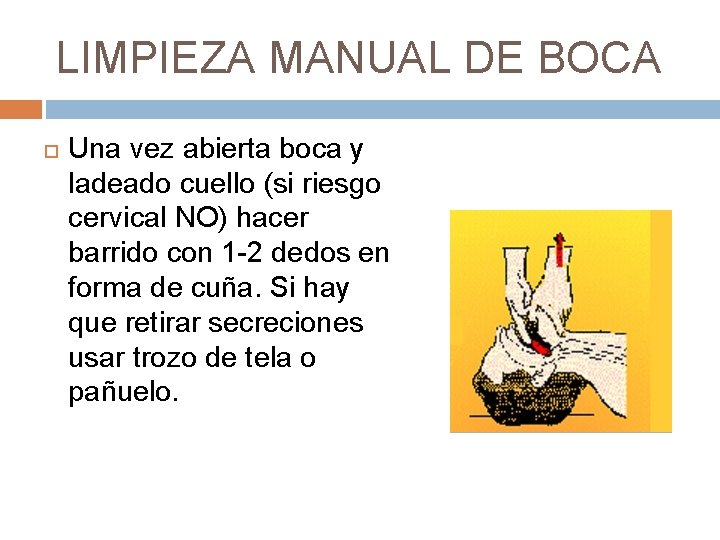 LIMPIEZA MANUAL DE BOCA Una vez abierta boca y ladeado cuello (si riesgo cervical