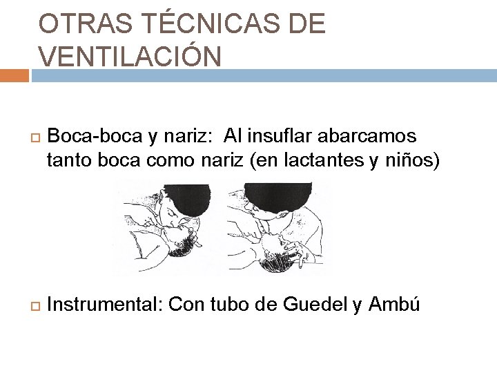 OTRAS TÉCNICAS DE VENTILACIÓN Boca-boca y nariz: Al insuflar abarcamos tanto boca como nariz