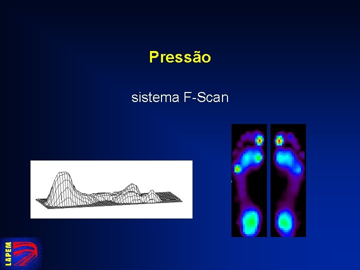 Pressão sistema F-Scan 