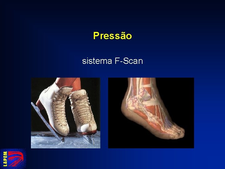 Pressão sistema F-Scan 