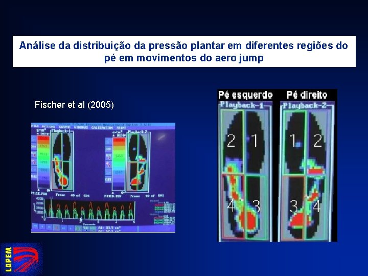 Análise da distribuição da pressão plantar em diferentes regiões do pé em movimentos do