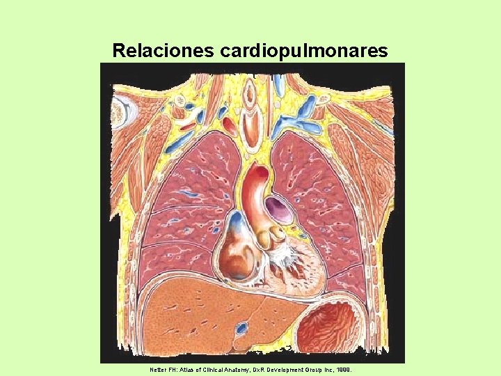 Relaciones cardiopulmonares Netter FH: Atlas of Clinical Anatomy, Dx. R Development Group Inc, 1999.