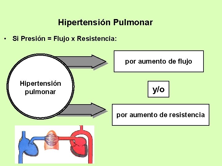 Hipertensión Pulmonar • Si Presión = Flujo x Resistencia: por aumento de flujo Hipertensión