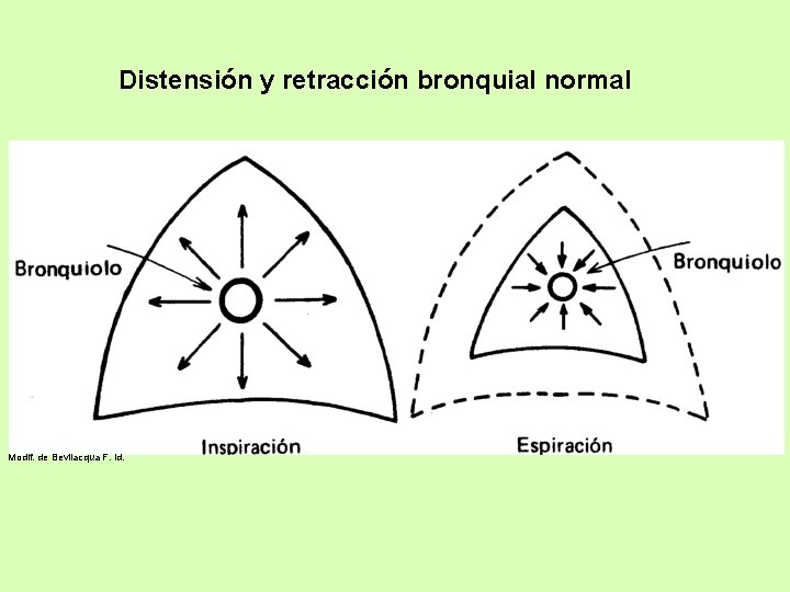Distensión y retracción bronquial normal Modif. de Bevilacqua F. id. 
