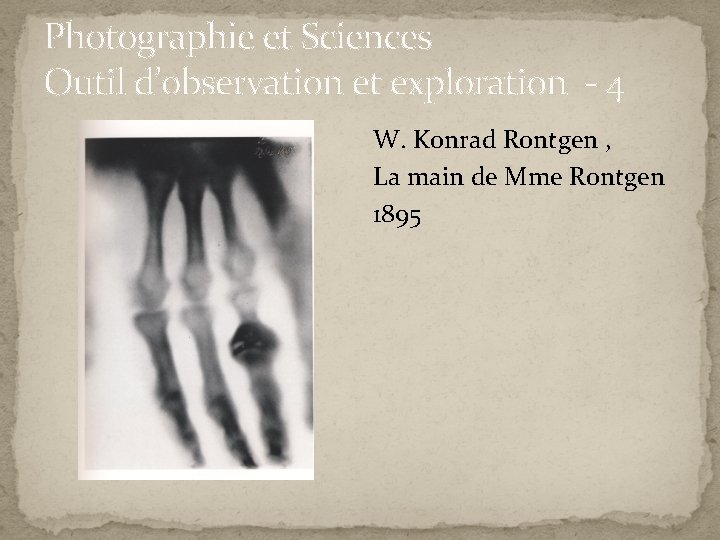 Photographie et Sciences Outil d’observation et exploration - 4 W. Konrad Rontgen , La