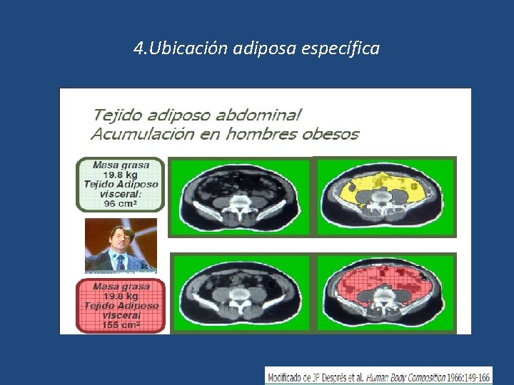 4. Ubicación adiposa específica 