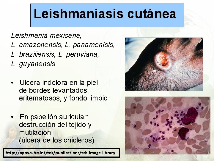 Leishmaniasis cutánea Leishmania mexicana, L. amazonensis, L. panamenisis, L. braziliensis, L. peruviana, L. guyanensis