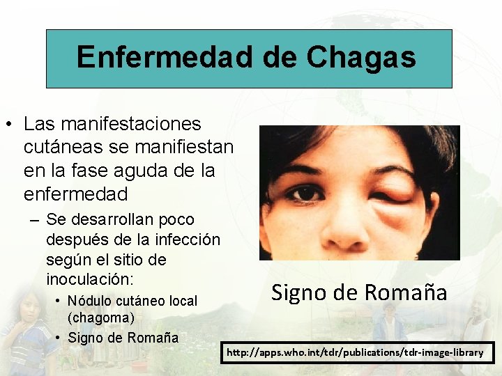 Enfermedad de Chagas • Las manifestaciones cutáneas se manifiestan en la fase aguda de