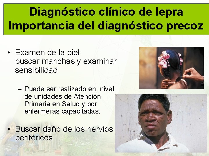 Diagnóstico clínico de lepra Importancia del diagnóstico precoz • Examen de la piel: buscar