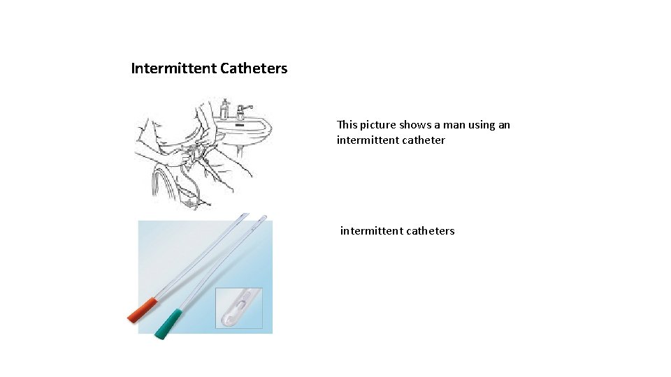 Intermittent Catheters This picture shows a man using an intermittent catheters 