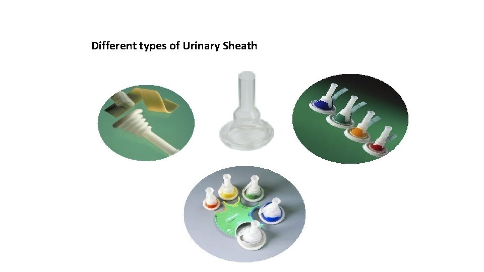 Different types of Urinary Sheath 