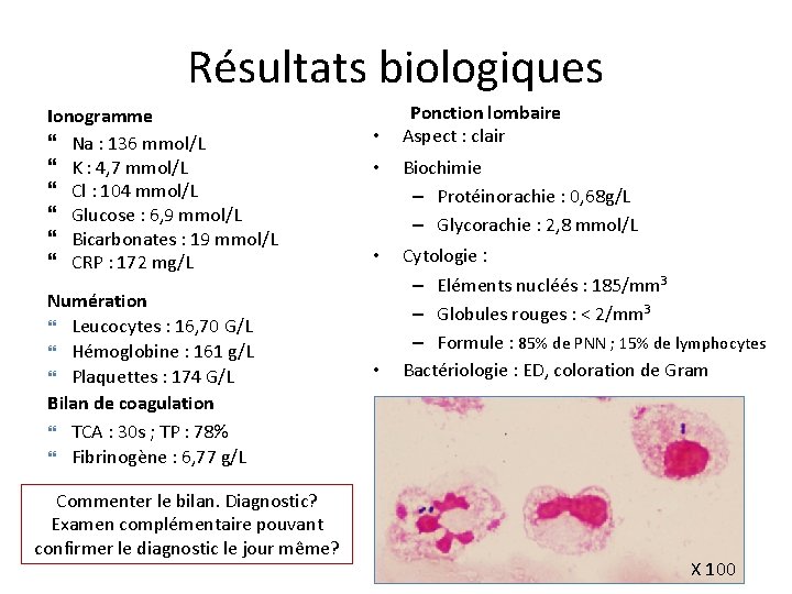 Résultats biologiques Ionogramme Na : 136 mmol/L K : 4, 7 mmol/L Cl :