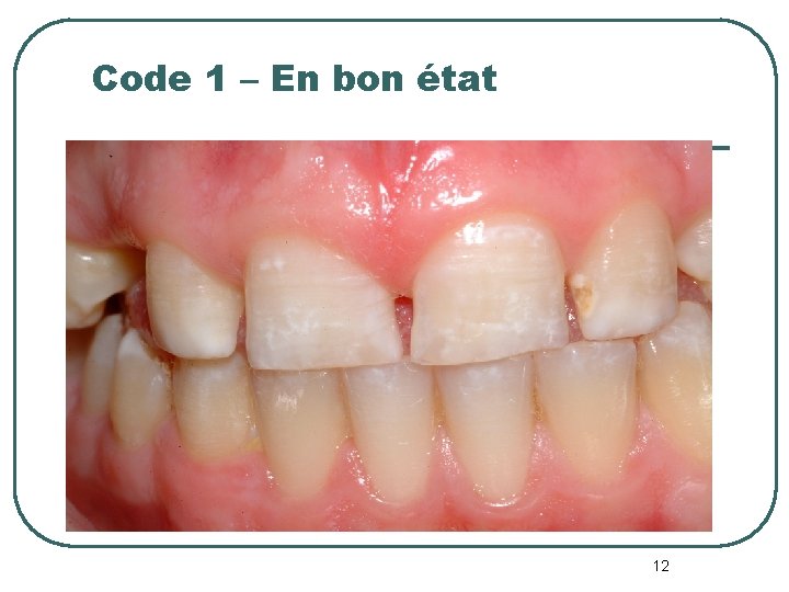 Code 1 – En bon état 12 Code 1 – En bon état 12
