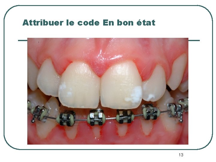 Attribuer le code En bon état 13 Attribuer le code En bon état 13