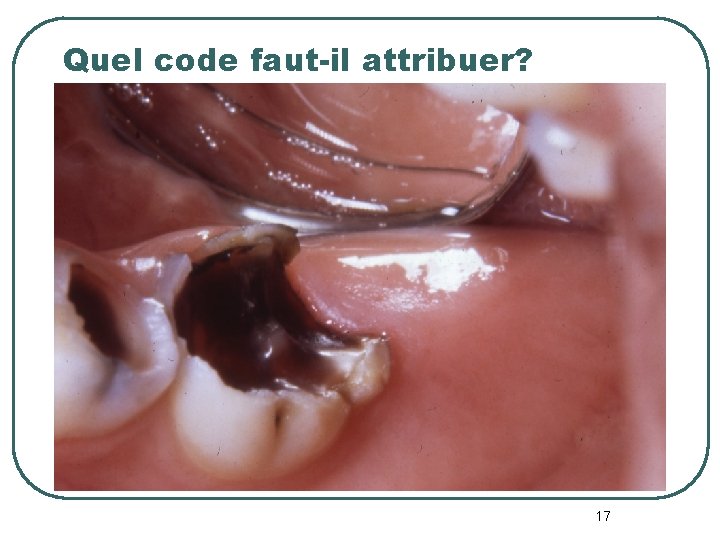 Quel code faut-il attribuer? 17 Quel code faut-il attribuer? 17