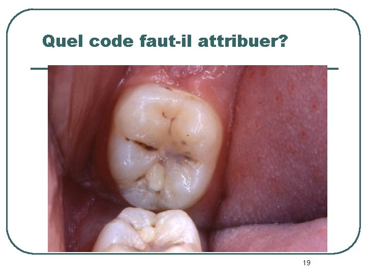 Quel code faut-il attribuer? 19 Quel code faut-il attribuer? 19