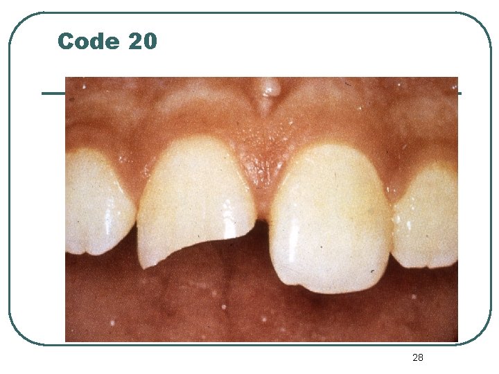 Code 20 28 Code 20 28