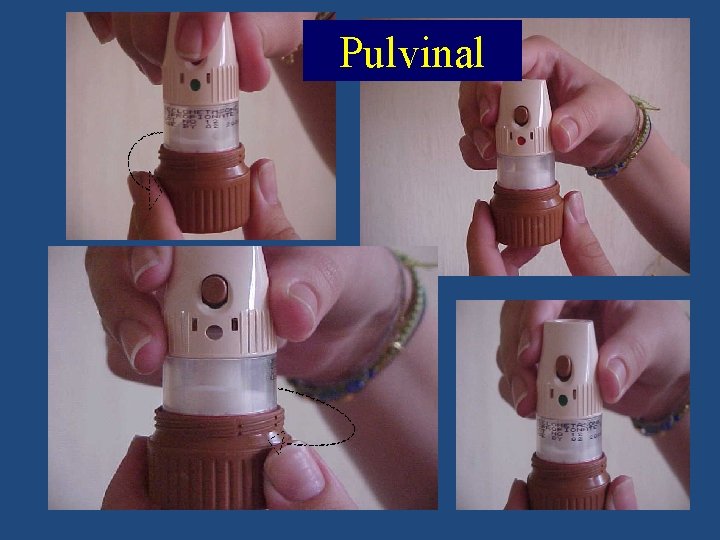Pulvinal 