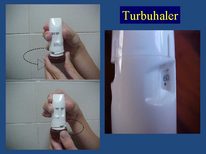 Turbuhaler 