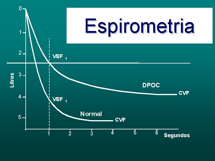 0 VEF 1 / CVF Espirometria Normal DPOC 1 2 Litros 1 VEF 4.