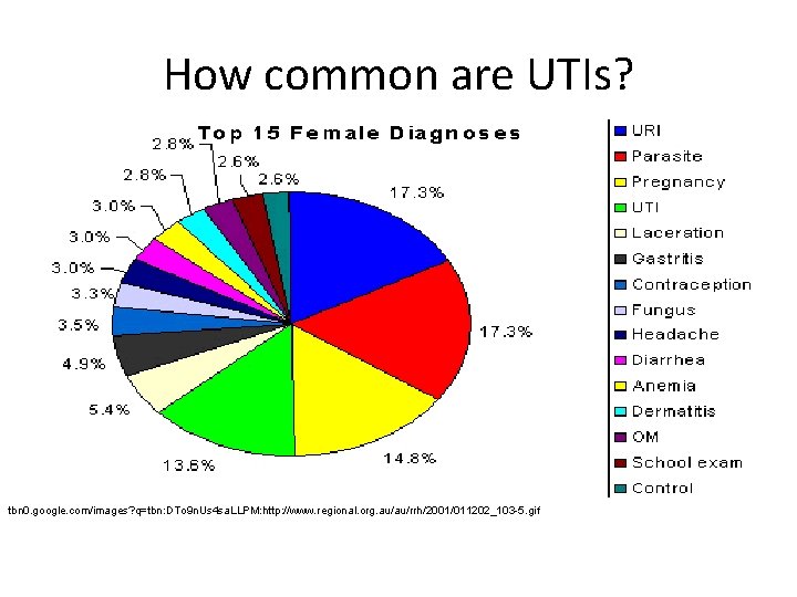 How common are UTIs? tbn 0. google. com/images? q=tbn: DTo 9 n. Us 4