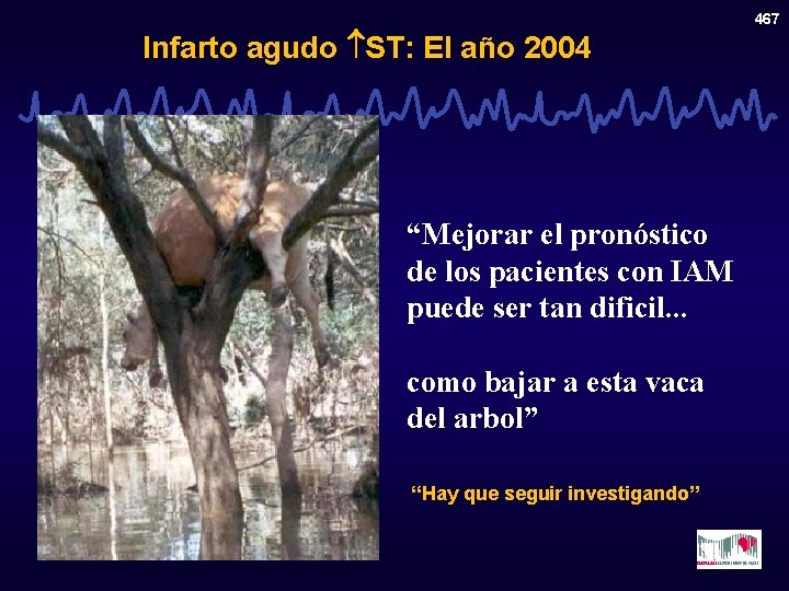 Infarto agudo ST: El año 2004 “Mejorar el pronóstico de los pacientes con IAM