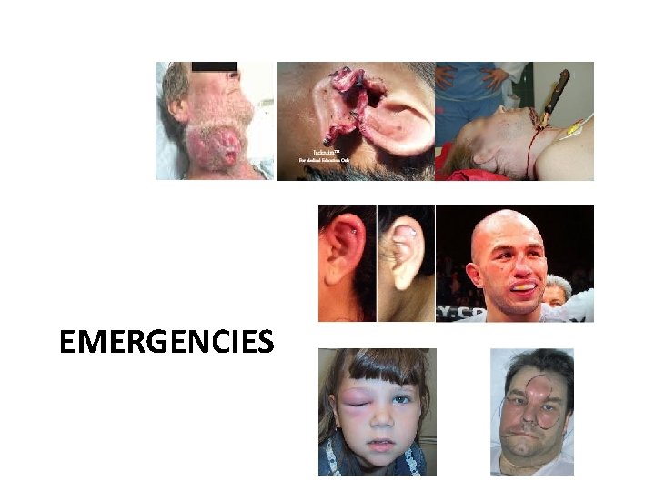 EMERGENCIES 