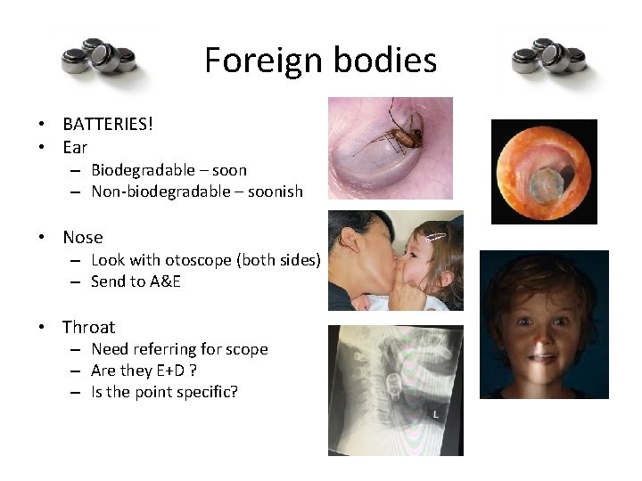 Foreign bodies • BATTERIES! • Ear – Biodegradable – soon – Non-biodegradable – soonish