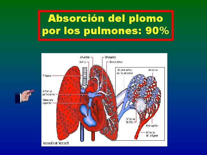 Absorción del plomo por los pulmones: 90% 