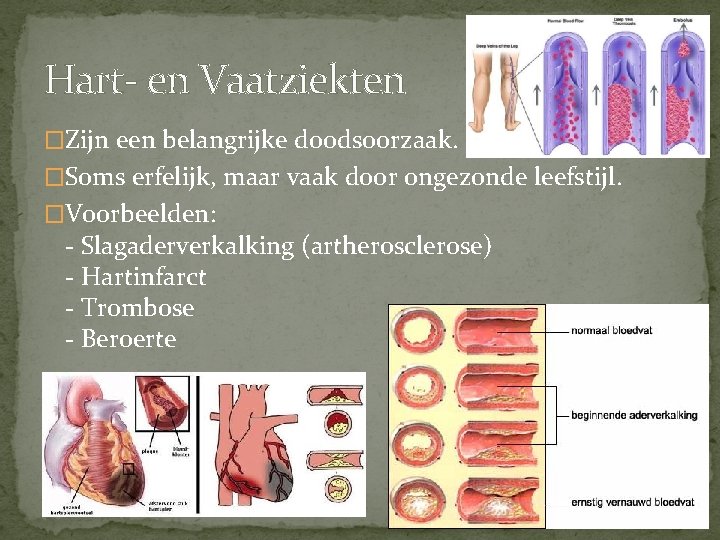 Hart- en Vaatziekten �Zijn een belangrijke doodsoorzaak. �Soms erfelijk, maar vaak door ongezonde leefstijl.