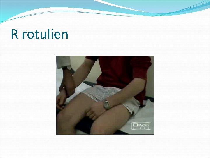 R rotulien 