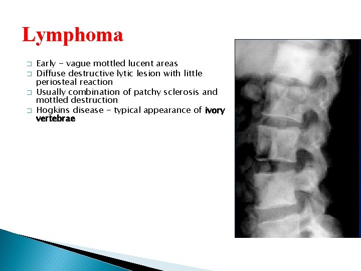 Lymphoma � � Early - vague mottled lucent areas Diffuse destructive lytic lesion with