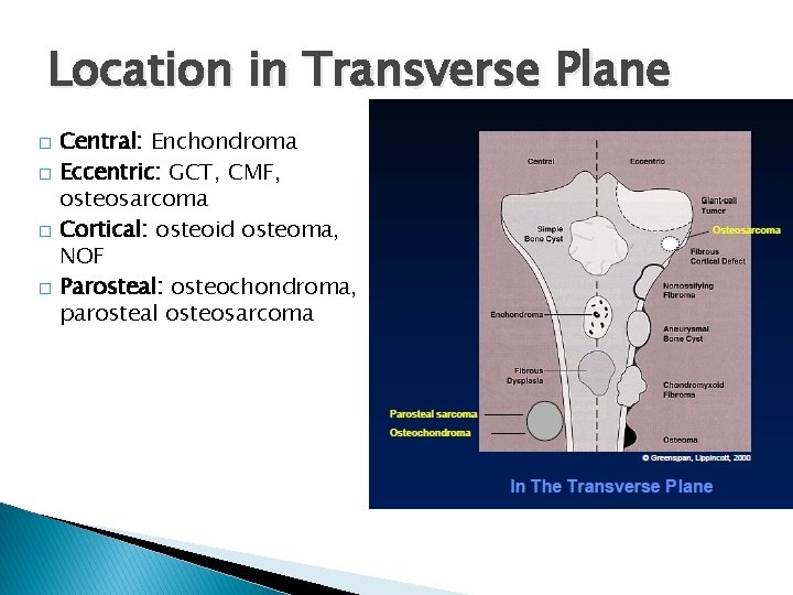 Location in Transverse Plane � � Central: Enchondroma Eccentric: GCT, CMF, osteosarcoma Cortical: osteoid