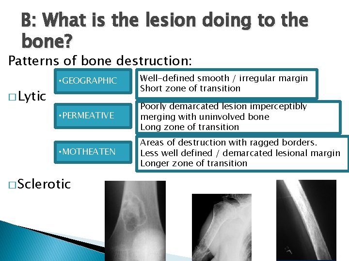 B: What is the lesion doing to the bone? Patterns of bone destruction: �