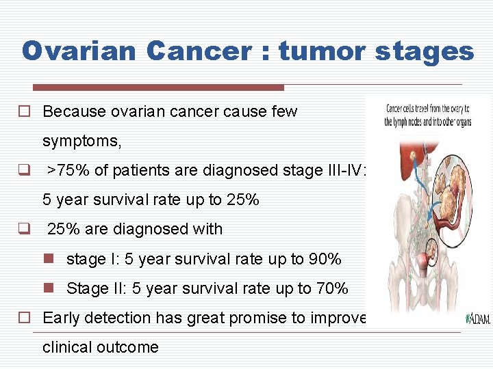 Ovarian Cancer : tumor stages o Because ovarian cancer cause few symptoms, q >75%